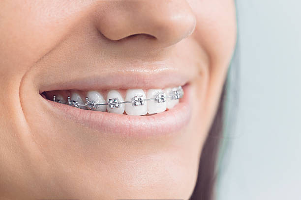 Best Dental Fillings (Composite and Amalgam)  in Williamsport, PA